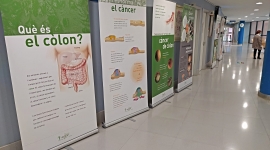 Consultes Externes de l’Hospital de Figueres acull una exposició sobre el càncer de còlon i recte