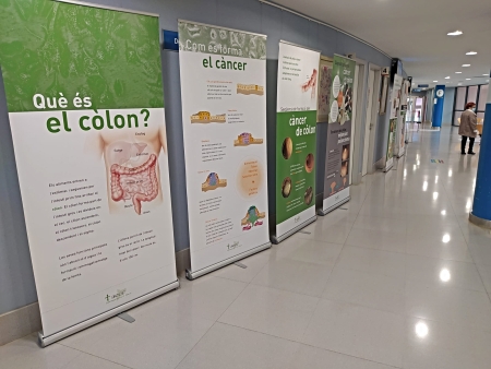 Exposició sobre el càncer de còlon i recte