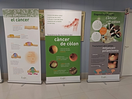 Exposició sobre el càncer de còlon i recte
